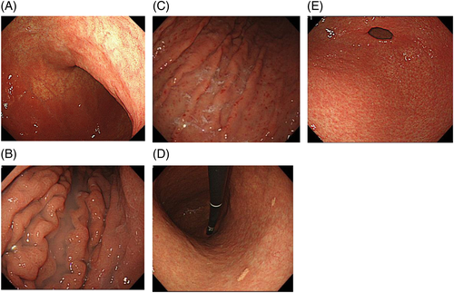 Details are in the caption following the image Details are in the caption following the image
