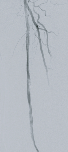 Details are in the caption following the image