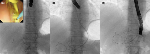 Details are in the caption following the image Details are in the caption following the image