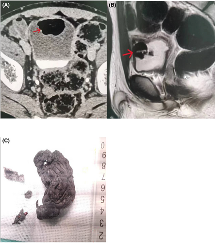 Details are in the caption following the image Details are in the caption following the image
