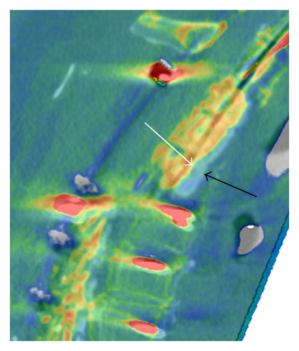 Details are in the caption following the image