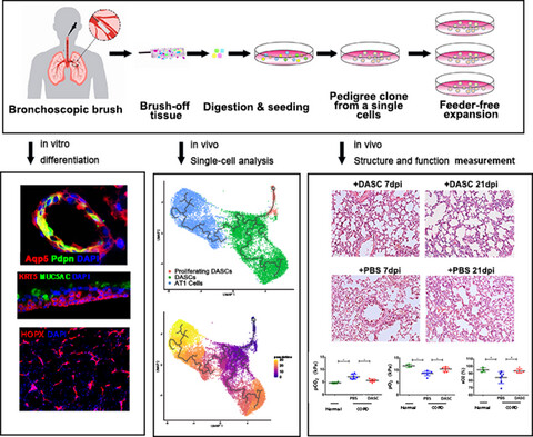 Intrapulmonary distal airway stem cell transplantation repairs lung injury in chronic obstructive pulmonary disease