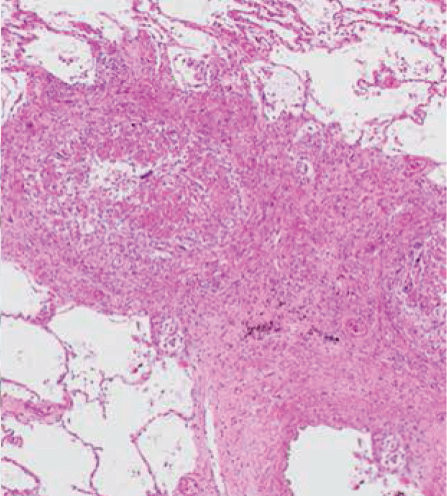 Details are in the caption following the image