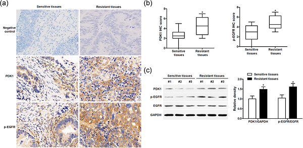 Pyruvate dehydrogenase kinase 1 contributes to cisplatin resistance of ovarian cancer through EGFR activation