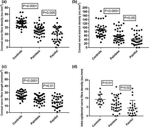Greater small nerve fibre damage in the skin and cornea of type 1 diabetic patients with painful compared to painless diabetic neuropathy