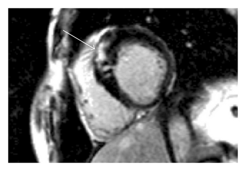 Details are in the caption following the image