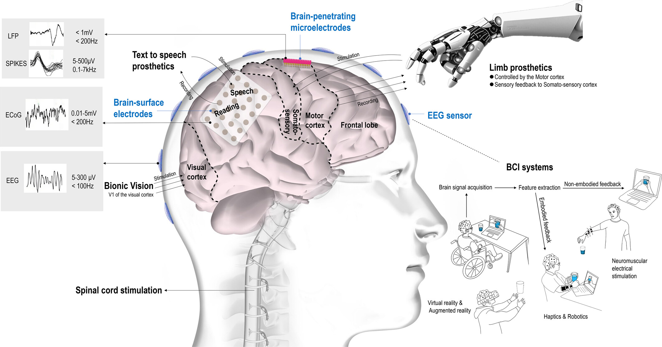 Brain–computer interfaces in 2023–2024