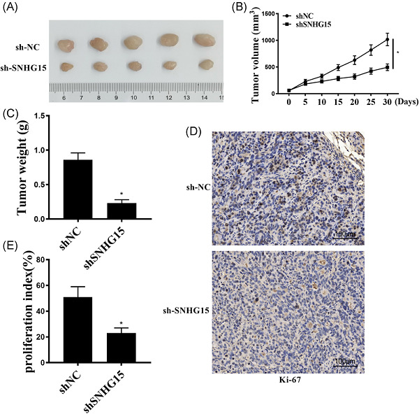 The lncRNA SNHG15/miR-18a-5p axis promotes cell proliferation in ovarian cancer through activating Akt/mTOR signaling pathway