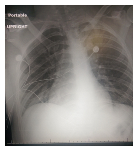 Details are in the caption following the image