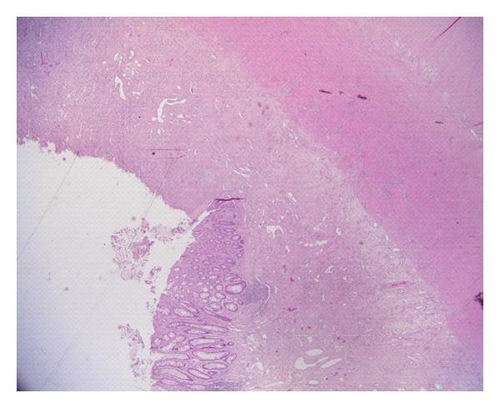 Details are in the caption following the image