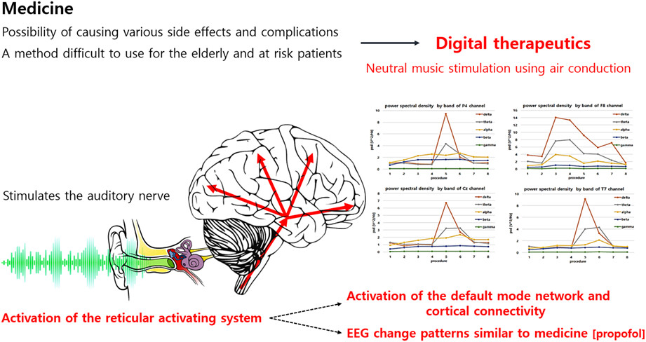 The sound stimulation method and EEG change analysis for development of digital therapeutics that can stimulate the nervous system: Cortical activation and drug substitution potential