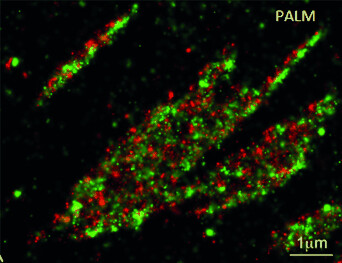 Single Molecules, Cells, and Super-Resolution Optics (Nobel Lecture)