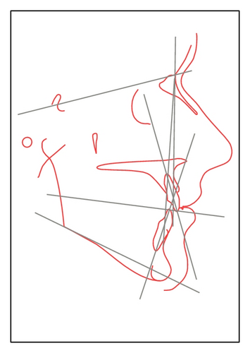 Details are in the caption following the image