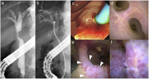 Details are in the caption following the image Details are in the caption following the image