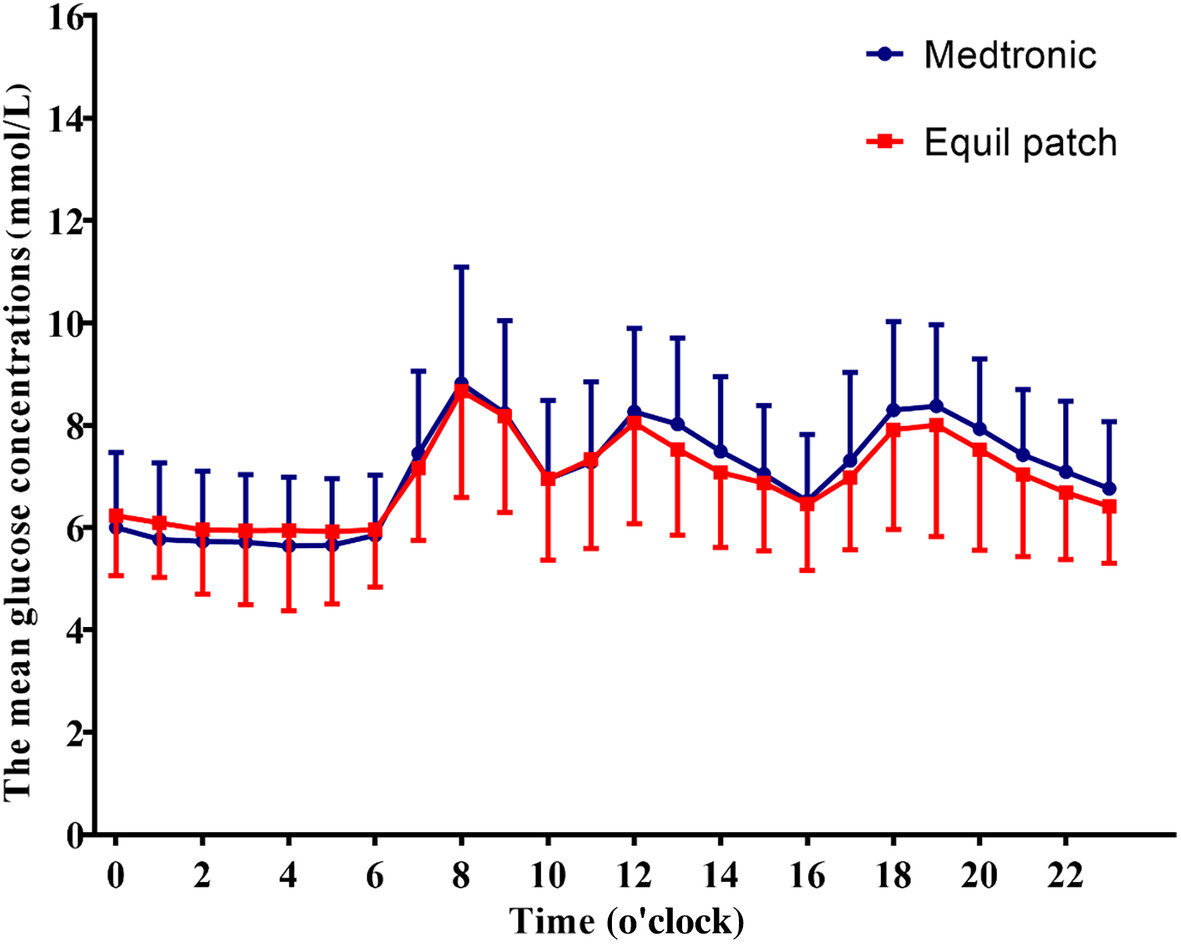 Comparing Equil patch versus traditional catheter insulin pump in type 2 diabetes using continuous glucose monitoring metrics and profiles