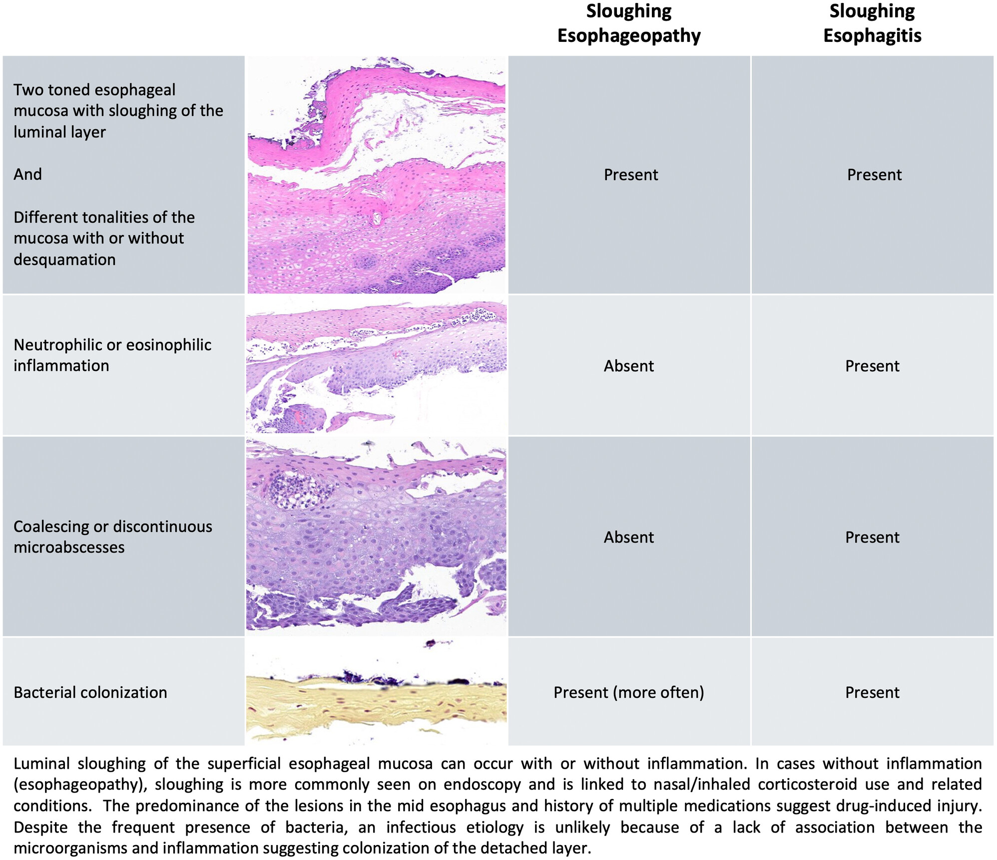 A reappraisal of oesophageal mucosal biopsy specimens showing sloughing