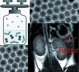 Simple Synthesis and Functionalization of Iron Nanoparticles for Magnetic Resonance Imaging