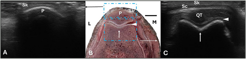 Details are in the caption following the image