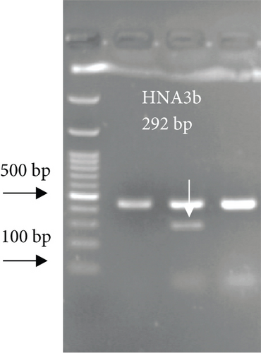 Details are in the caption following the image