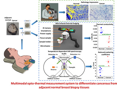 Thermo-optic measurements and their inter-dependencies for delineating cancerous breast biopsy tissue from adjacent normal