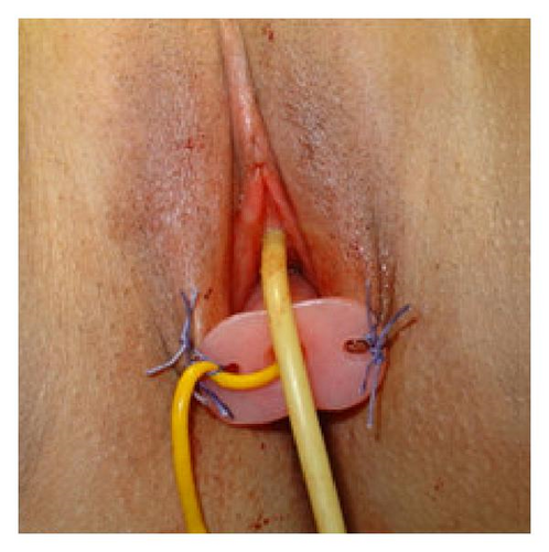 Details are in the caption following the image Details are in the caption following the image