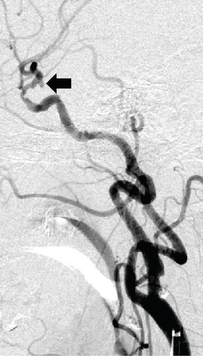 Details are in the caption following the image