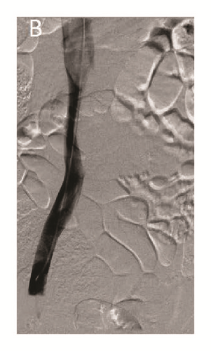 Details are in the caption following the image