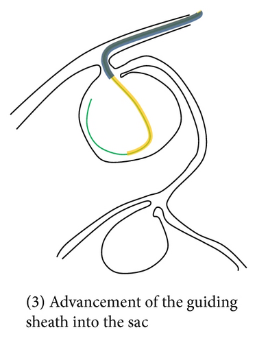 Details are in the caption following the image