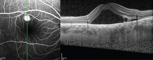 Details are in the caption following the image Details are in the caption following the image
