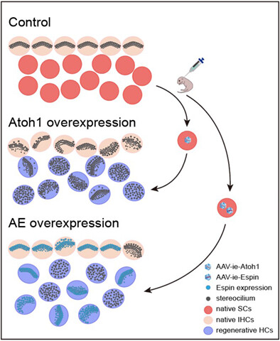 The role of Espin in the stereocilia regeneration and protection in Atoh1-overexpressed cochlear epithelium