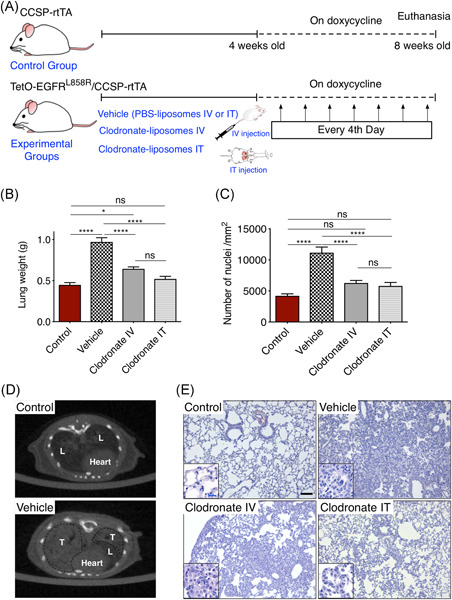 Targeting alveolar macrophages shows better treatment response than deletion of interstitial macrophages in EGFR mutant lung adenocarcinoma