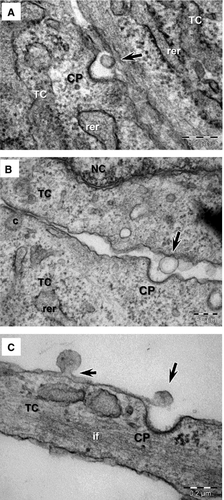 Details are in the caption following the image