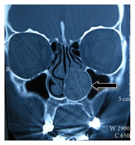 Details are in the caption following the image