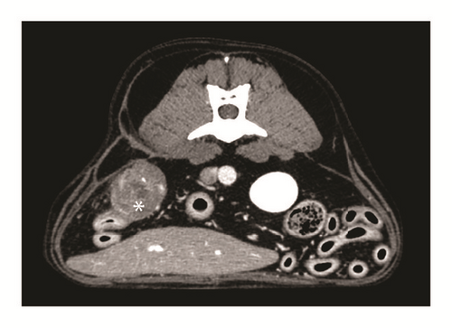 Details are in the caption following the image