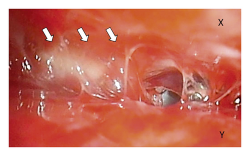 Details are in the caption following the image