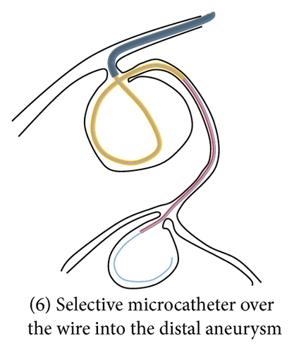 Details are in the caption following the image