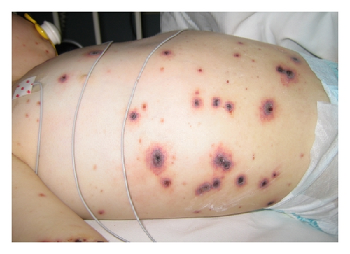 Details are in the caption following the image Details are in the caption following the image