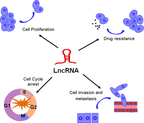 The long non-coding RNA landscape in triple-negative breast cancer