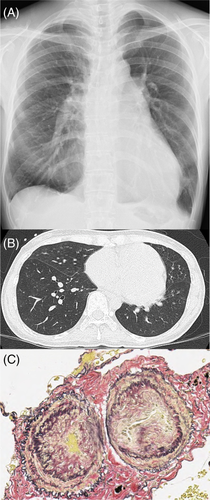 Details are in the caption following the image Details are in the caption following the image