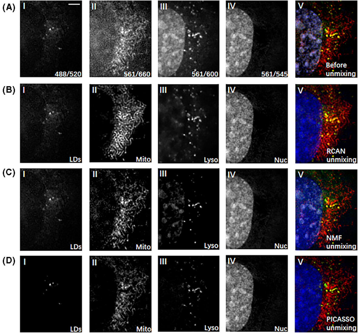 Multi-color two-laser super-resolution structured illumination microscopy for the visualization of multi-organelle in living cells