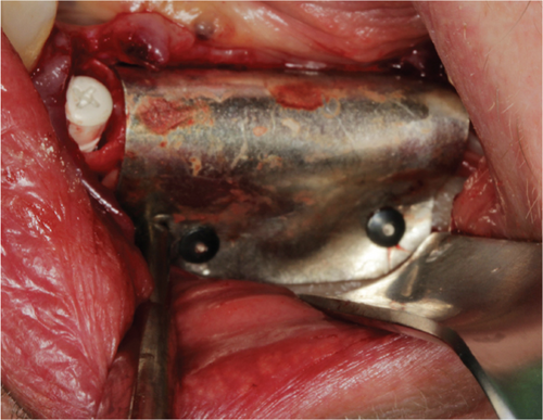 Details are in the caption following the image Details are in the caption following the image