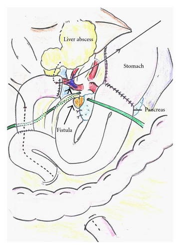 Details are in the caption following the image Details are in the caption following the image