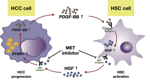 STMN1 upregulation mediates hepatocellular carcinoma and hepatic stellate cell crosstalk to aggravate cancer by triggering the MET pathway