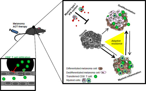 The myeloid cell type I IFN system promotes antitumor immunity over pro-tumoral inflammation in cancer T-cell therapy