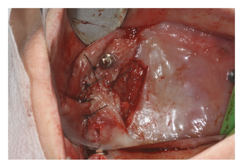 Details are in the caption following the image Details are in the caption following the image