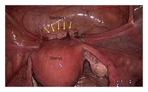 Details are in the caption following the image Details are in the caption following the image