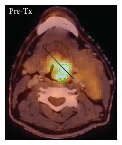 Details are in the caption following the image Details are in the caption following the image