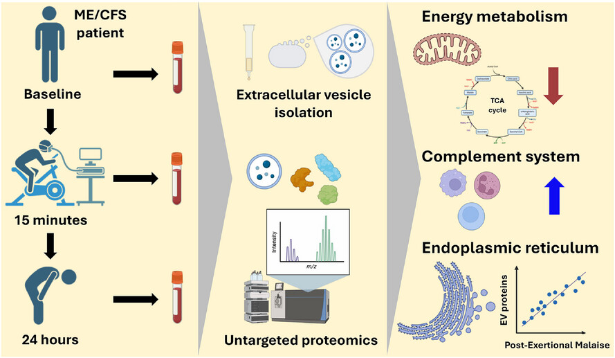 Extracellular vesicle proteomics uncovers energy metabolism, complement system, and endoplasmic reticulum stress response dysregulation postexercise in males with myalgic encephalomyelitis/chronic fatigue syndrome