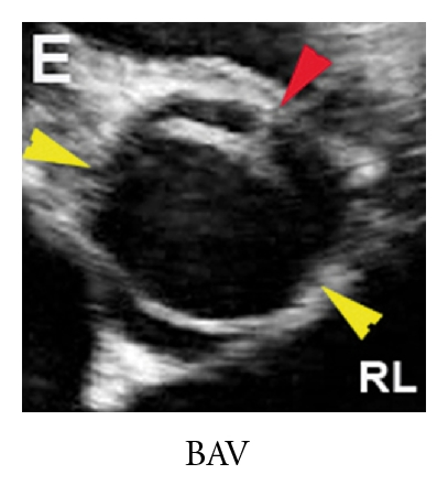 Details are in the caption following the image