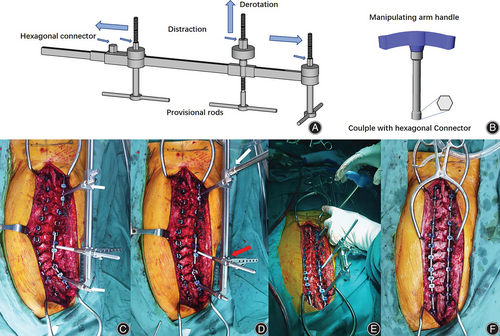Details are in the caption following the image Details are in the caption following the image
